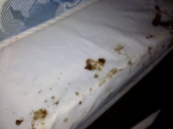 Do I Have Bed Bugs?